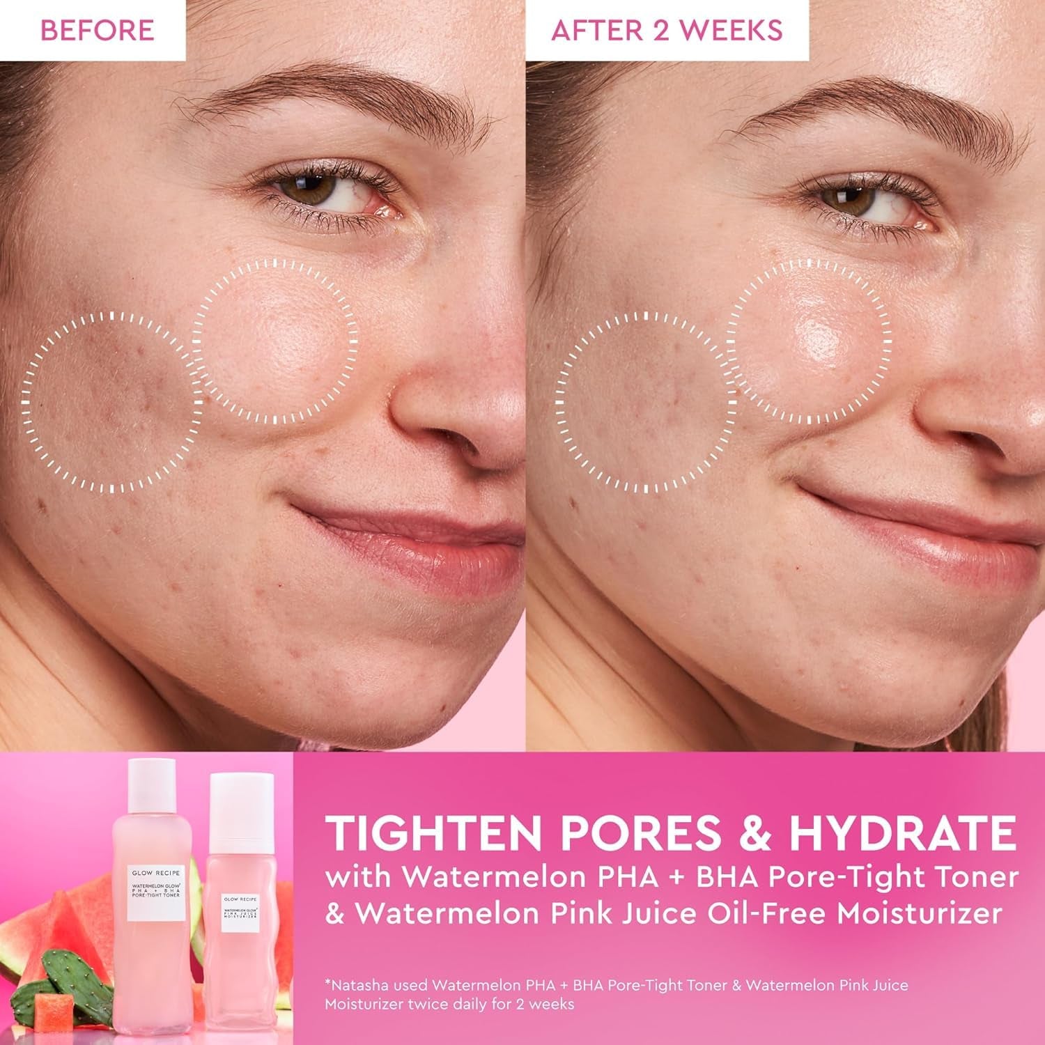 Glow Recipe Limited Edition Pride PHA + BHA Face Toner - Skin Care Toner, Pore Minimizer & Gentle Face Exfoliant - Soothing, Tightening & Hydrating Toner with Hyaluronic Acid & Watermelon (150Ml)
